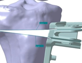 اصلاح بدشکلی (دفورمیتی ) های استخوانی با کمک سه بعدی سازی کامپیوتری